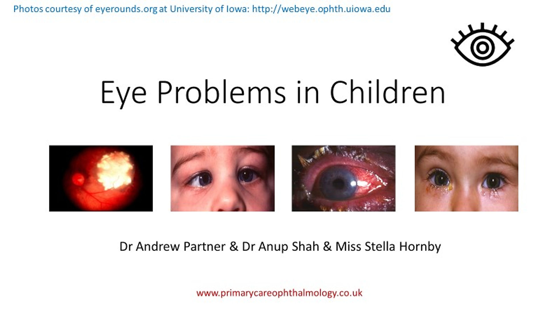 Eye Problems in Children